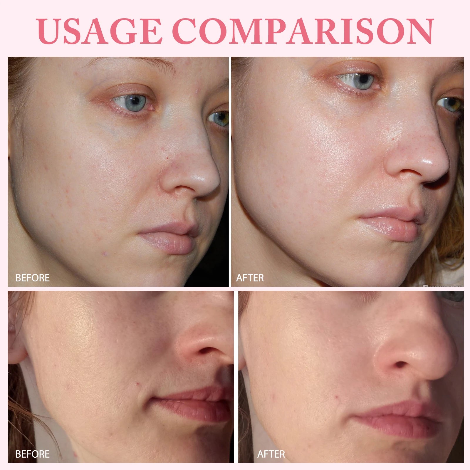 10pcs/Box PDRN Pink One Day Serum Deep Moisturizing,Repairs,Brightens,Reduces Sagging Skin Care Essence Multi-effect Benefits